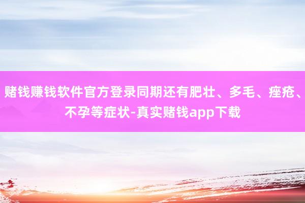 赌钱赚钱软件官方登录同期还有肥壮、多毛、痤疮、不孕等症状-真实赌钱app下载
